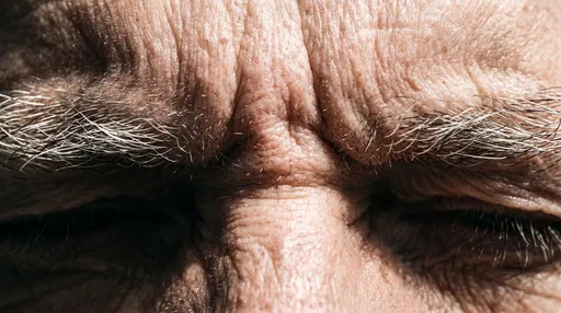 Macro Close-Up of Furrowed Brow