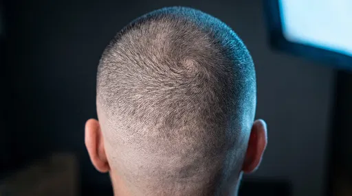 Close-Up of Man's Buzz Cut Crown