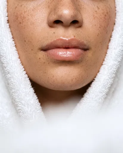 Close-Up of Freckled Woman in Spa Towel
