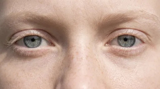 Macro Close-Up of Fair Eyes and Freckles