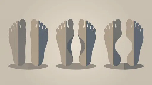 Flat Normal and High Foot Arches Illustration